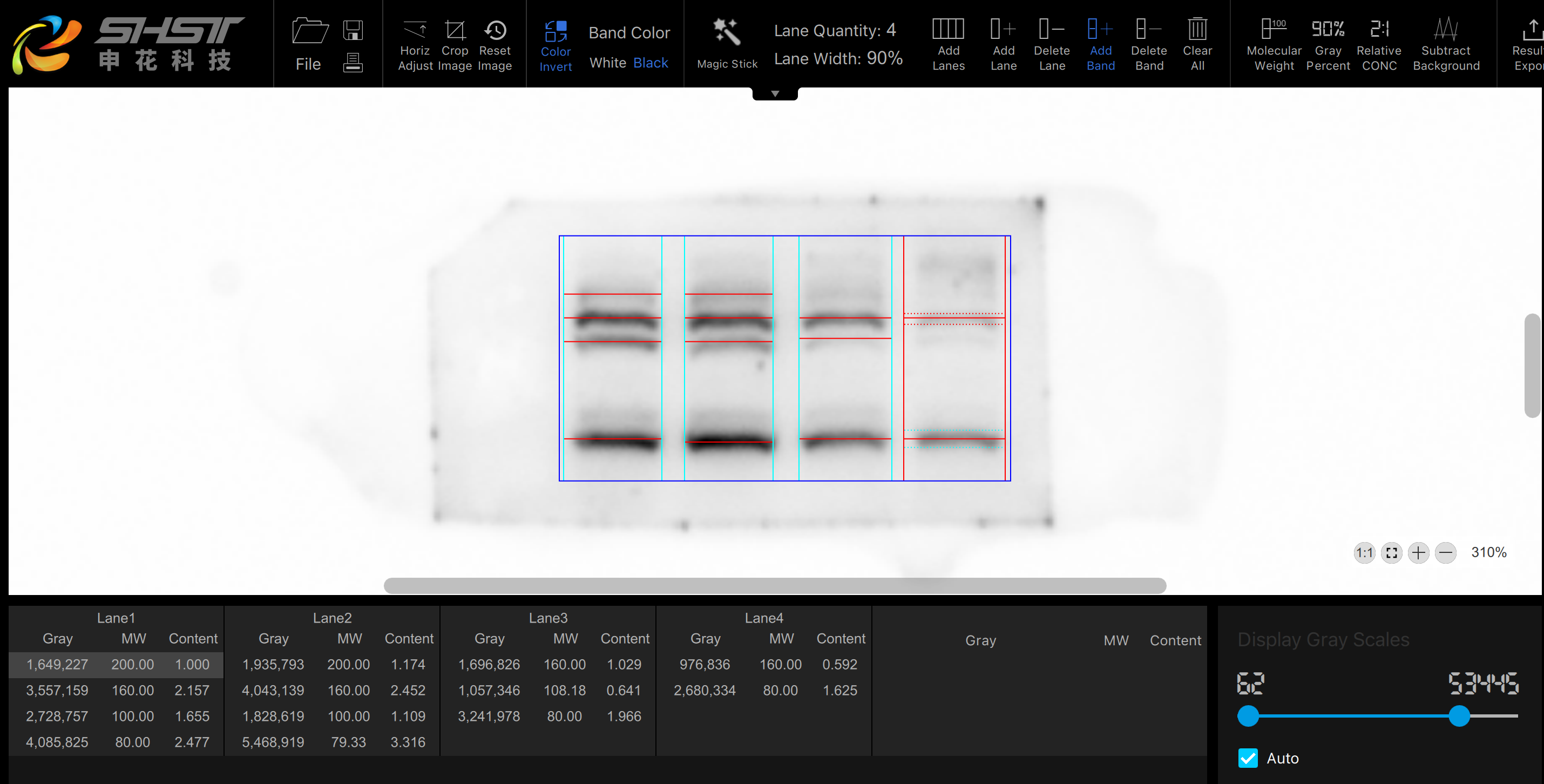 Western-Blot-Analyse